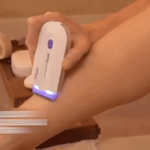 Depiladora Yes Recargable